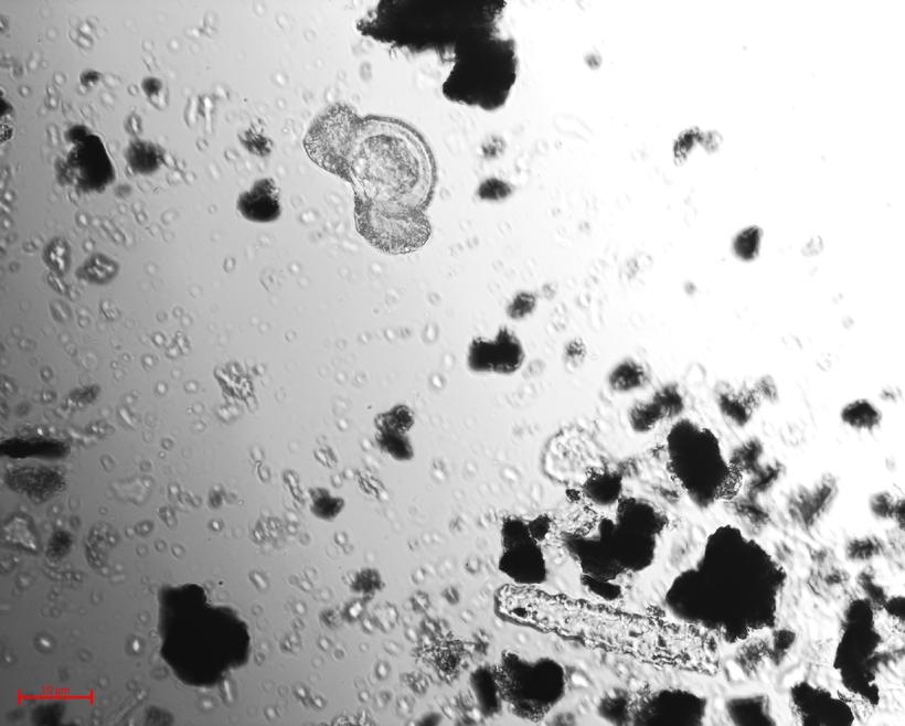 Fossil pollen grain