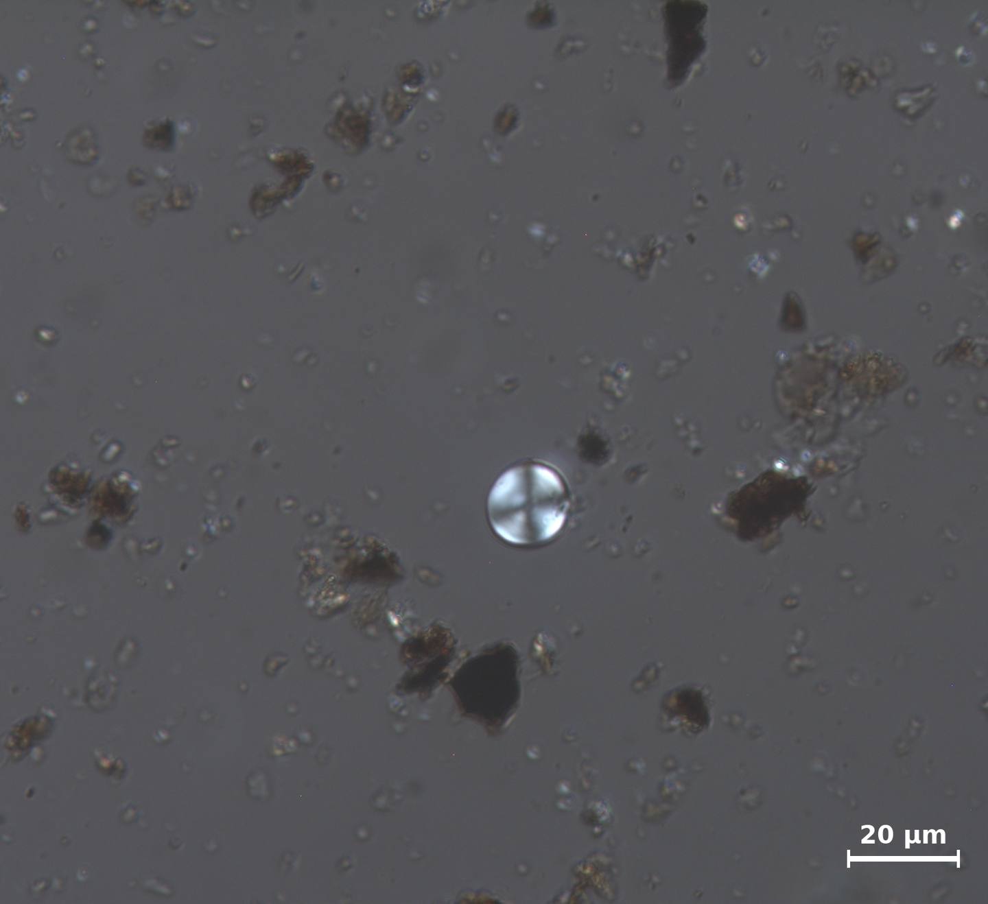Starch grain recovered from ceramic residue